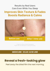 Medicube Kojic Acid Turmeric Wrapping Mask 75ml — Reveal a fresh-looking glow. Peel away the dried film the next morning.