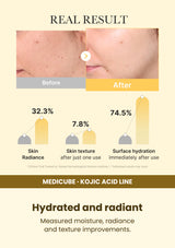 Medicube Kojic Acid Turmeric Gel Mask 4 Masks — Hydrated and radiant. Measured moisture, radiance and texture improvements.