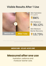 Medicube Kojic Acid Turmeric Jelly Mist 100ml — Measured after one use. Hydration, radiance and moisture-barrier care.