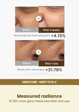 Medicube Deep Vita C Capsule Serum 30ml — Measured radiance