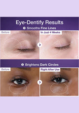 Before and after effects of eye cream on fine lines and dark circles with a purple background.