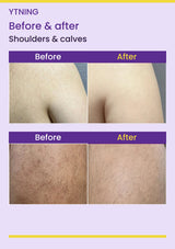 YTNING Scaling Toning Scrub Wash before-and-after shoulders & calves photographs with readable English labels