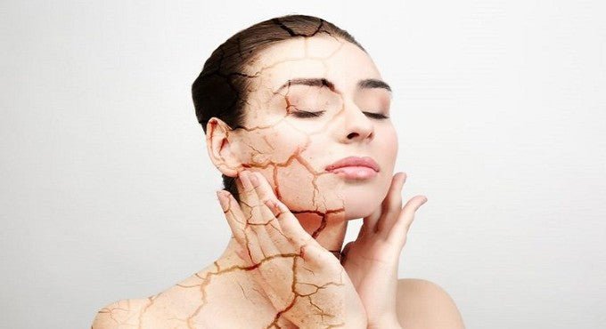 Don’t Let Your Dry Skin Persist Anymore - COCOMO