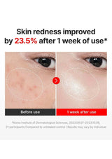 Centellian24 Madeca Cream Time Reverse visible redness improvement after one week
