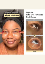 ABIB Collagen Eye Patch customer under-eye comparison after three weeks