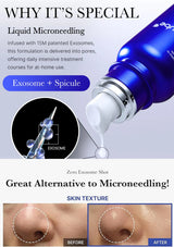 Blue microneedling device with exosome and spicule components, showing before and after skin texture images.