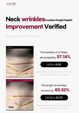 Advertisement for neck wrinkles improvement patch showing before and after effects.