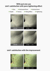 Before and after effects of a skincare product on skin pores and texture.