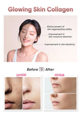 Advertisement for Glowing Skin Collagen with a woman's face before and after treatment, showing improvements in skin regenerative ability, moisture retention, and elasticity.