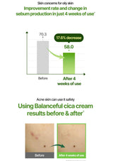 Graph showing improvement in sebum production after using a balance cica cream, with 'Before' and 'After' images of skin.