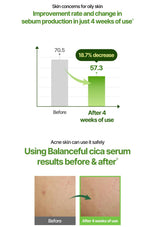 Graph showing improvement in sebum production for oily skin after using Balanceful cica serum.