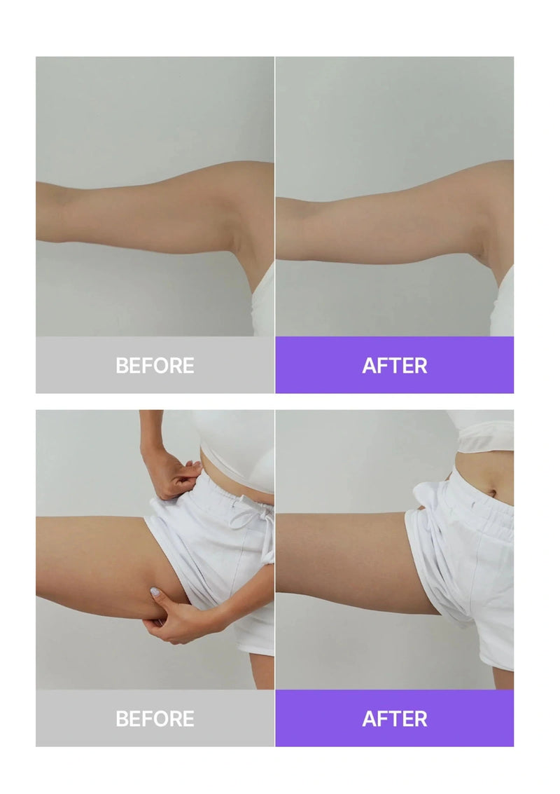 Before and after comparison of a person's legs and waist area with a purple 'After' label.