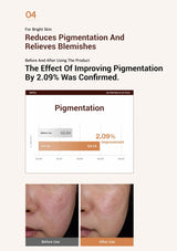 Advertisement for a product that reduces pigmentation and relieves blemishes, showing before and after effects on skin.