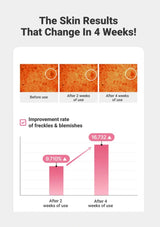 Before and after skin improvement results with a graph showing freckles and blemishes reduction over 4 weeks.