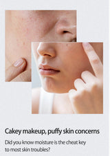 Close-up of skin with puffy areas and text about cakey makeup and moisture concerns.