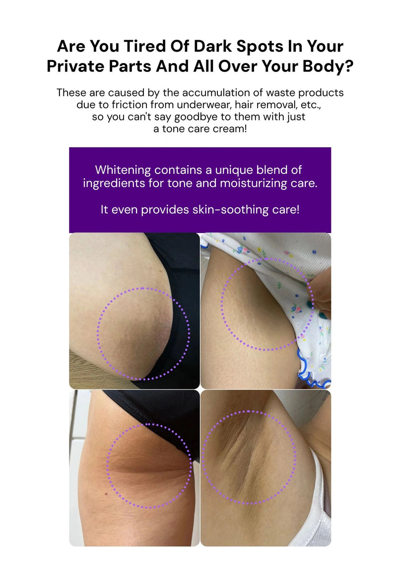 Advertisement for a skin whitening product with images of dark spots on skin and text about product benefits.