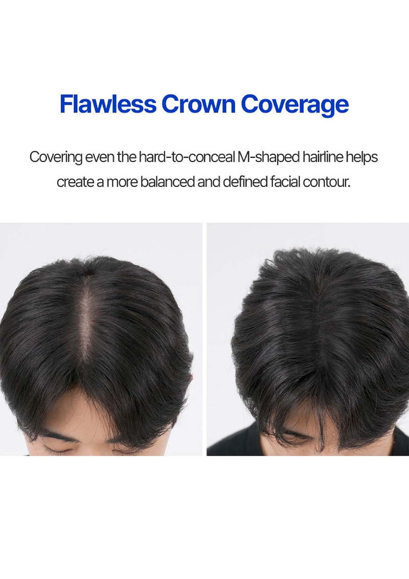 Comparison of M-shaped hairline before and after Flawless Crown Coverage with text on a white background.