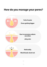 Diagram showing different skin conditions related to pores on a white background