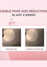Before and after comparison of pore size reduction with text 'Visible Pore Size Reduction in Just 4 Weeks!' on a pink background.