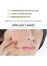 Before and after comparison of skin with text highlighting improvements after a week.