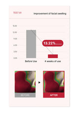 Graph showing improvement of facial swelling with a before and after comparison.