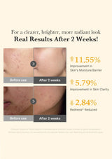 Before and after skin comparison with text on a beige background