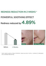 Advertisement showing redness reduction in 2 weeks with a before and after comparison on a white background.