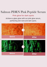 Advertisement for Salmon PDRN Pink Peptide Serum showing before and after effects on skin.