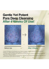 Advertisement for pore deep cleansing product showing before and after effects on skin.
