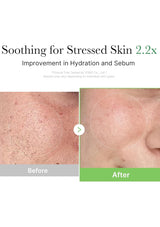 Before and after comparison of skin with text 'Soothing for Stressed Skin 2.2x' on a white background.