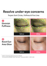 An informational before-and-after graphic for an under-eye treatment. The top text reads 'Resolve under-eye concerns' and 'Targets Dark Circles, Puffiness & Fine Lines.
