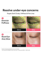 An informational before-and-after graphic for an under-eye treatment. The top text reads 'Resolve under-eye concerns' and 'Targets Dark Circles, Puffiness & Fine Lines.