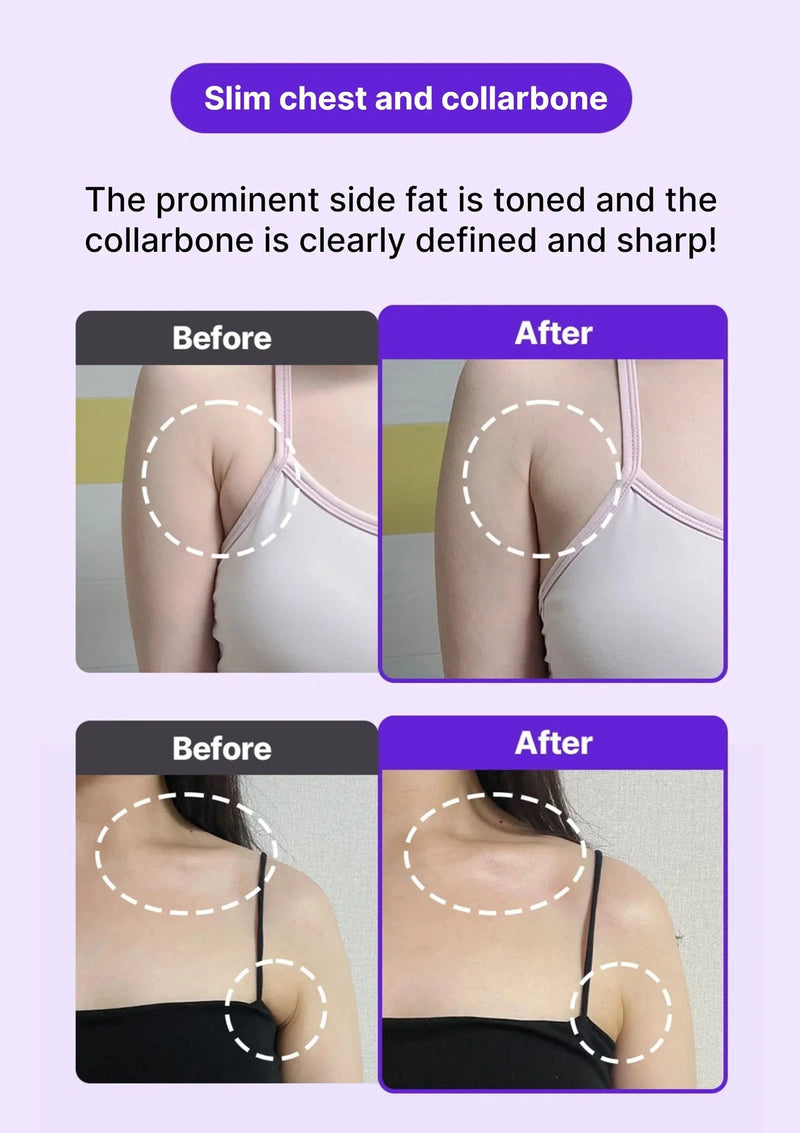 Before and after comparison of slim chest and collarbone with highlighted areas.