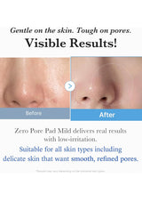 Before and after comparison of skin with pores, featuring text about product effectiveness and suitability for various skin types.