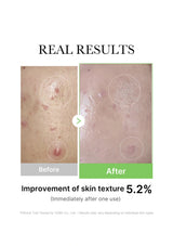Before and after comparison of skin texture improvement with text indicating 5.2% improvement.