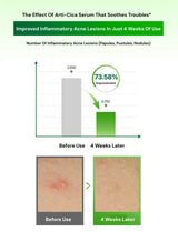 Graph and before/after skin condition images showing the effect of Arti-Cica Serum on inflammatory acne lesions.