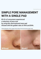 Advertisement for pore management product showing before and after effects on skin.