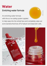 Product packaging with text about an enriching water formula for acne treatment.