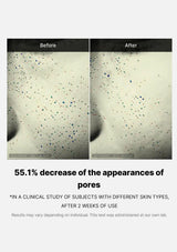 Before and after comparison of skin with pore reduction, showing a 55.1% decrease.