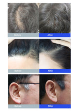 Before and after comparison of hair treatment on a person's head and ear.
