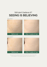 Before and after skin improvement results using a skincare product on a white background.