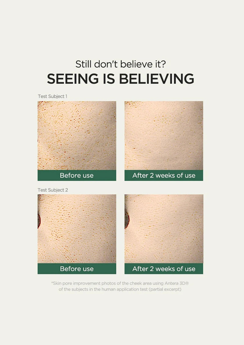 Before and after skin improvement results using a skincare product on a white background.