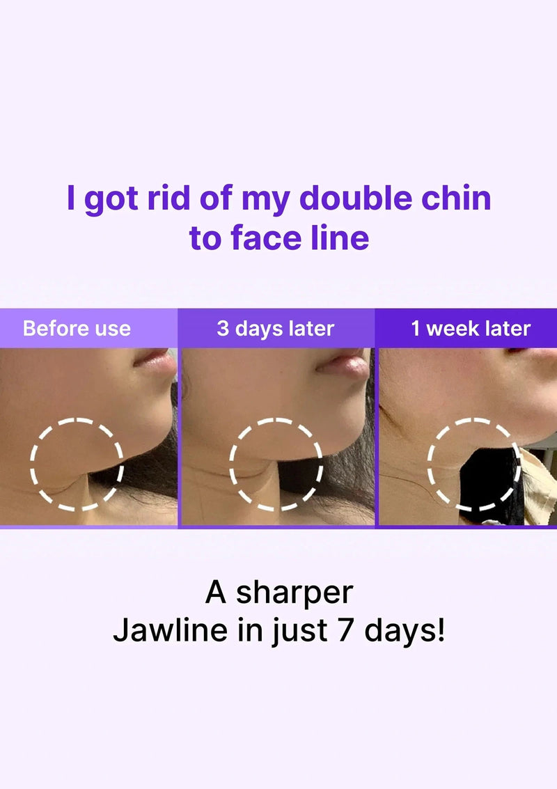 Before and after comparison of a double chin reduction treatment with text indicating results.