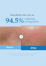 Before and after comparison of skin impurities reduction with text indicating 94.5% reduction.
