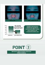 Before and after use comparison of a skincare product with statistical improvement data on a white background.
