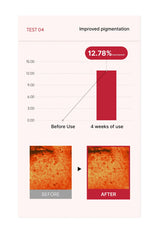 Graph and before/after images showing improved pigmentation after 4 weeks of use.