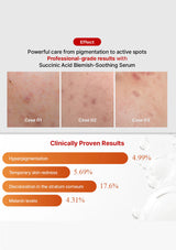 Advertisement for a skincare serum with before-and-after skin condition images and clinical results.