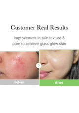 Before and after comparison of skin texture improvement with text 'Customer Real Results' and 'Improvement in skin texture & pore to achieve glass glow skin'.