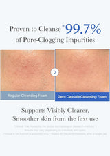 Comparison of regular cleansing foam and zero capsule cleansing foam on skin with text highlighting effectiveness.