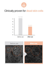 Graph and before/after images showing clinical results for dead skin cells reduction.